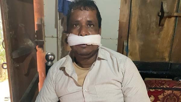 মুন্সিগঞ্জের সিরাজদীখানে রাস্তায় কলা গাছ ফেলে ডাকাতি