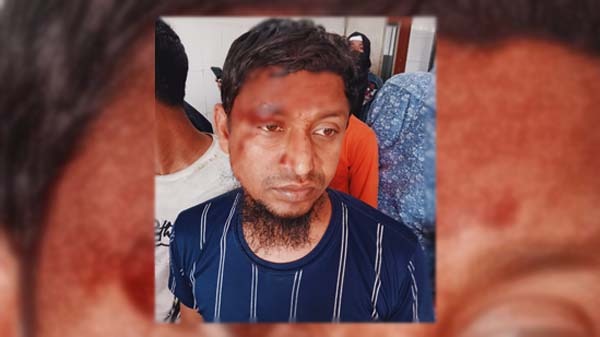 জমির বিরোধের জেরে কমলনগরে দু'গ্রুপের সংঘর্ষে আহত-১২