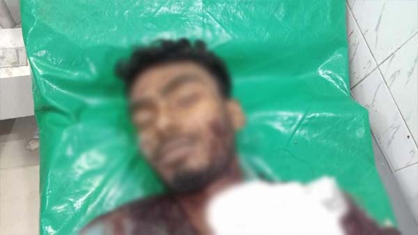 মোংলায় সড়ক দূর্ঘটনায় প্রাণ গেলো শিক্ষার্থীর